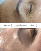 Wavederm Pro LED Light Therapy Device
